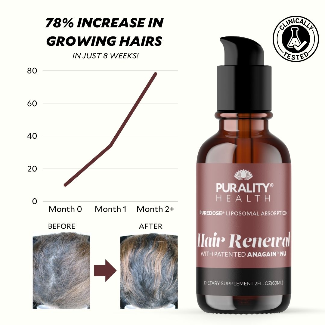 Liposomal Hair Renewal Bottle